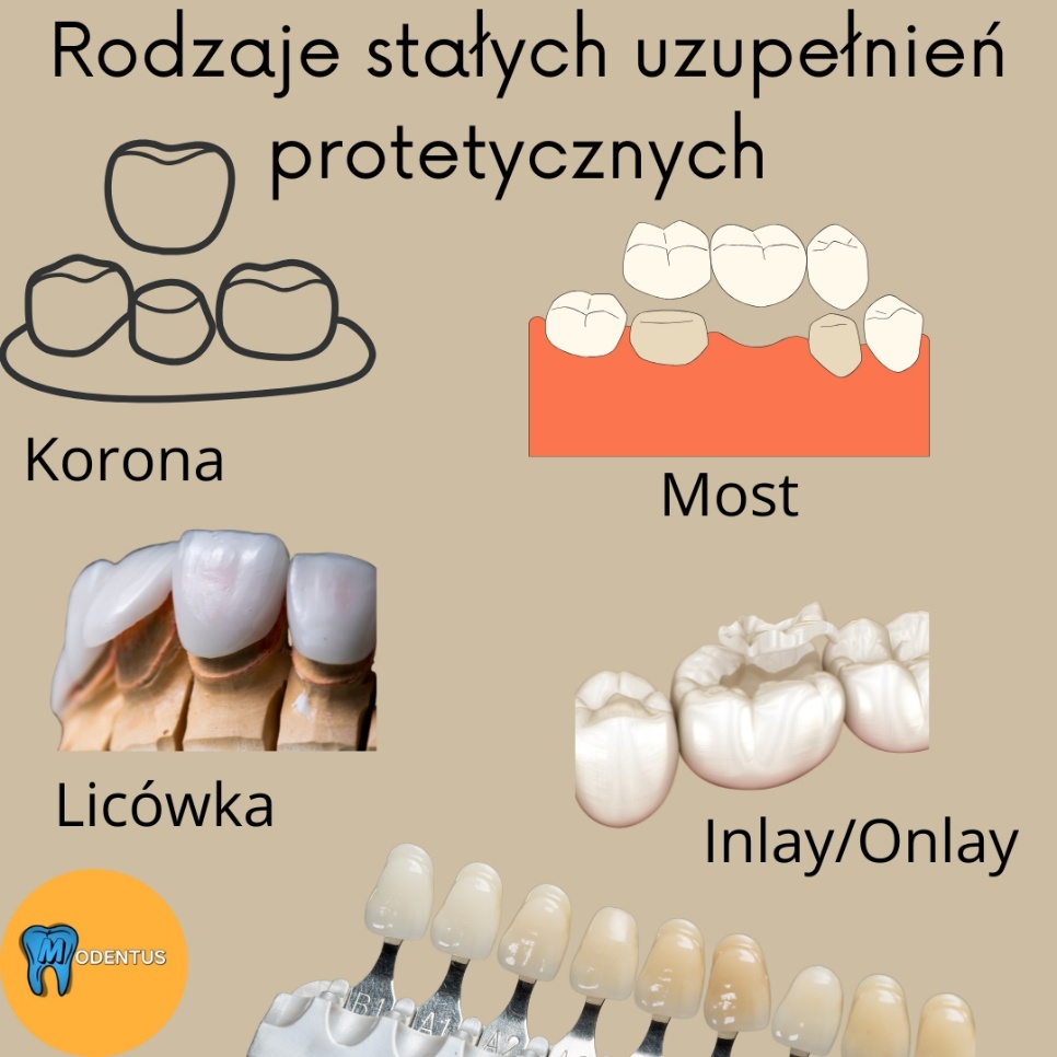 śmiejące się dziecko